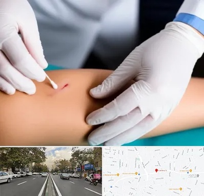 متخصص زخم عفونی در دولت 