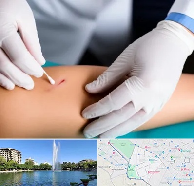 متخصص زخم عفونی در کوهسنگی مشهد 