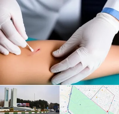 متخصص زخم عفونی در بلوار فلسیطین مشهد 