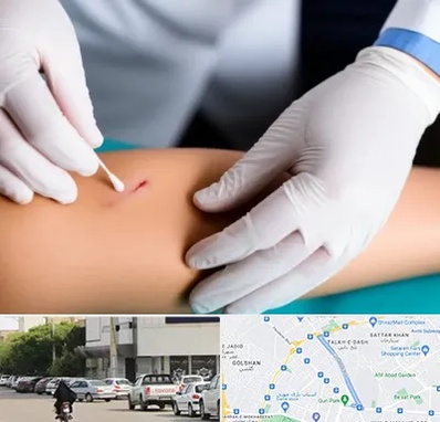 متخصص زخم عفونی در قدوسی شرقی شیراز 