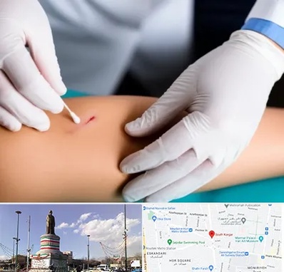 متخصص زخم عفونی در کارگر جنوبی