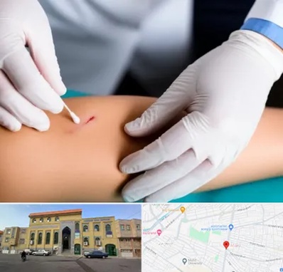 متخصص زخم عفونی در زنبیل آباد قم 