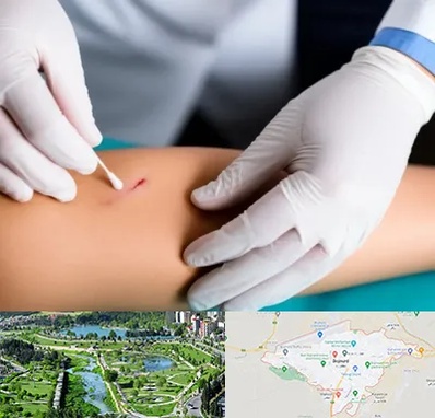 متخصص زخم عفونی در بجنورد