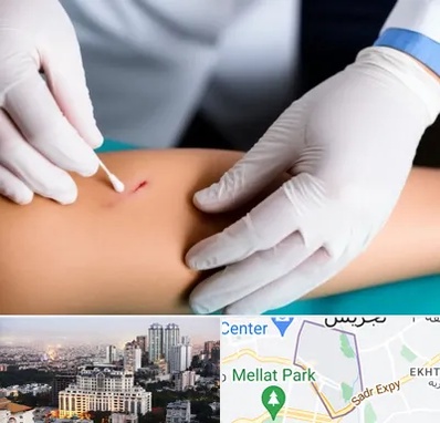 متخصص زخم عفونی در الهیه 