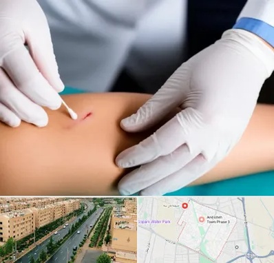 متخصص زخم عفونی در فاز سه اندیشه