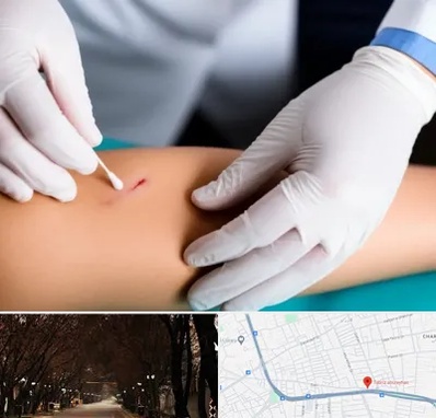 متخصص زخم عفونی در ابوریحان تبریز