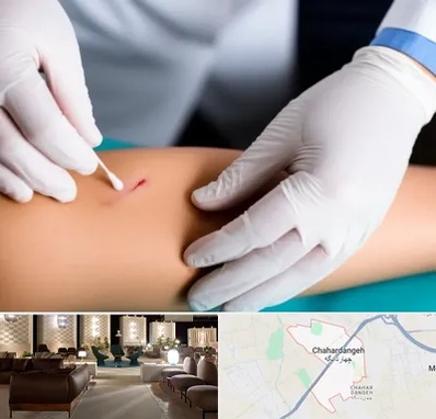 متخصص زخم عفونی در چهاردانگه