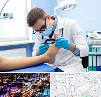 درمان زخم پای دیابتی در منظریه رشت 