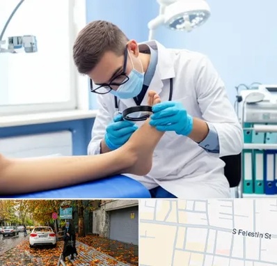 درمان زخم پای دیابتی در خیابان فلسطین 