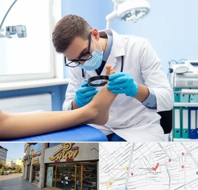 درمان زخم پای دیابتی در عطاران قم 