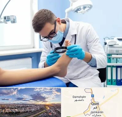 درمان زخم پای دیابتی در قم