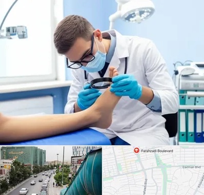 درمان زخم پای دیابتی در بلوار فرحزادی 