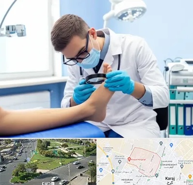 درمان زخم پای دیابتی در شاهین ویلا کرج 