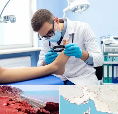 درمان زخم پای دیابتی در هرمزگان