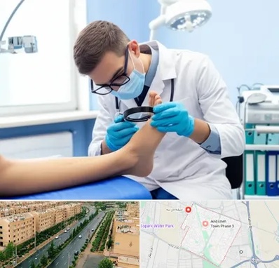 درمان زخم پای دیابتی در فاز سه اندیشه