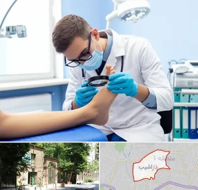 درمان زخم پای دیابتی در دزاشیب