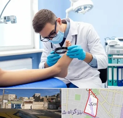 درمان زخم پای دیابتی در اتابک