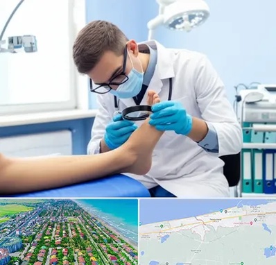 درمان زخم پای دیابتی در فریدونکنار