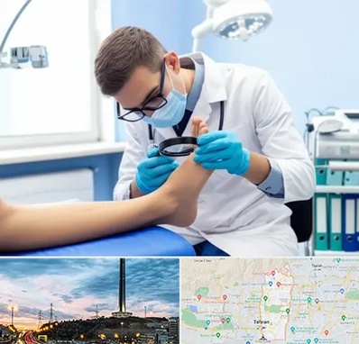 درمان زخم پای دیابتی در منطقه 2 تهران