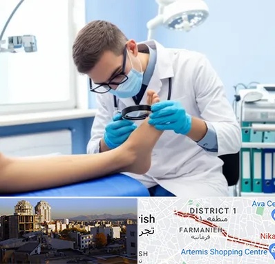 درمان زخم پای دیابتی در فرمانیه 