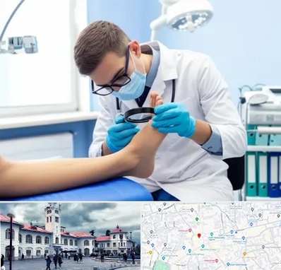 درمان زخم پای دیابتی در میدان شهرداری رشت 