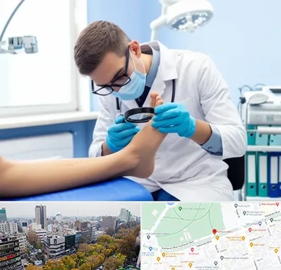 درمان زخم پای دیابتی در بلوار کشاورز 