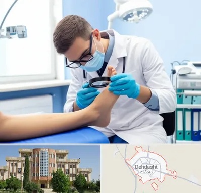 درمان زخم پای دیابتی در دهدشت