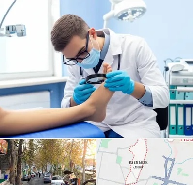 درمان زخم پای دیابتی در کاشانک