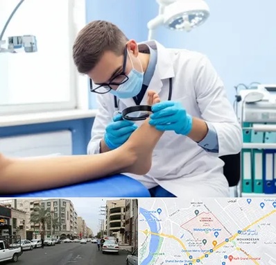 درمان زخم پای دیابتی در زیتون کارمندی اهواز 