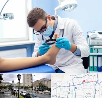درمان زخم پای دیابتی در شمال غرب تهران