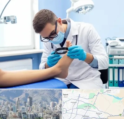 درمان زخم پای دیابتی در شمال شرق تهران