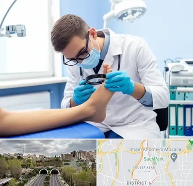 درمان زخم پای دیابتی در یوسف آباد