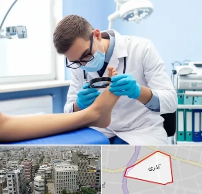 درمان زخم پای دیابتی در آذری