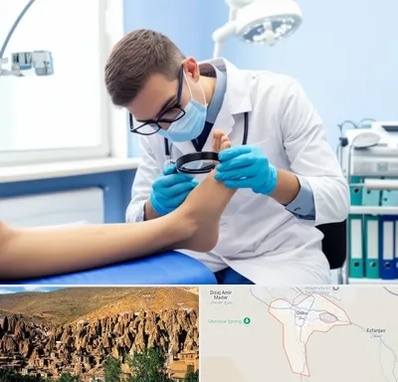 درمان زخم پای دیابتی در اسکو