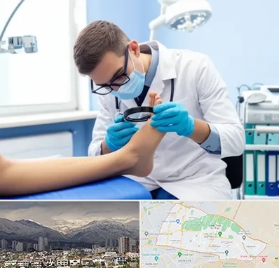 درمان زخم پای دیابتی در منطقه 4 تهران 