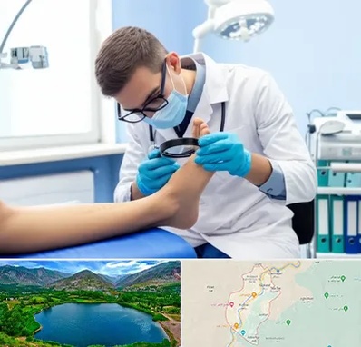 درمان زخم پای دیابتی در رودبار