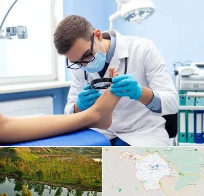 درمان زخم پای دیابتی در بهبهان