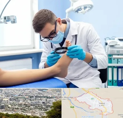 درمان زخم پای دیابتی در یاسوج