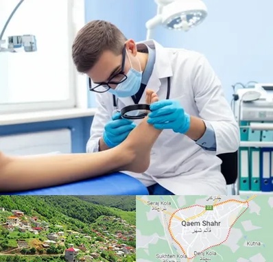 درمان زخم پای دیابتی در قائم شهر