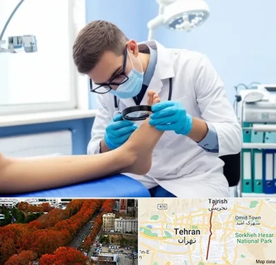 درمان زخم پای دیابتی در ولیعصر 