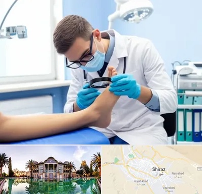 درمان زخم پای دیابتی در شیراز