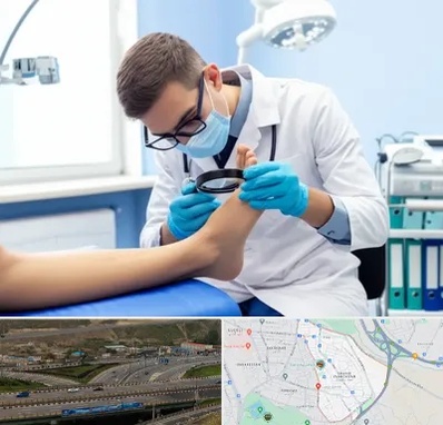 درمان زخم پای دیابتی در یاغچیان تبریز 