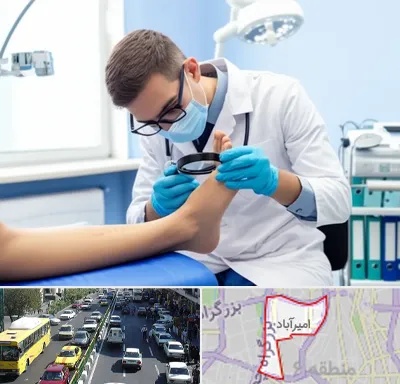 درمان زخم پای دیابتی در امیرآباد