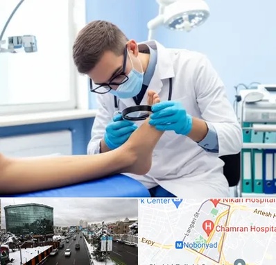 درمان زخم پای دیابتی در اقدسیه 