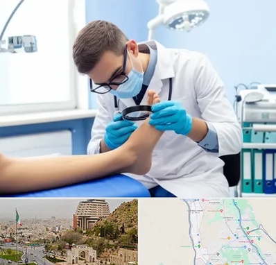 درمان زخم پای دیابتی در فرهنگ شهر شیراز