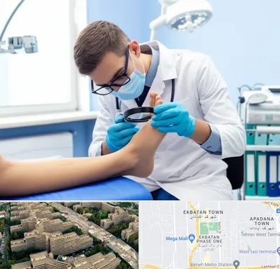 درمان زخم پای دیابتی در اکباتان 