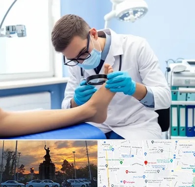درمان زخم پای دیابتی در میدان حر 