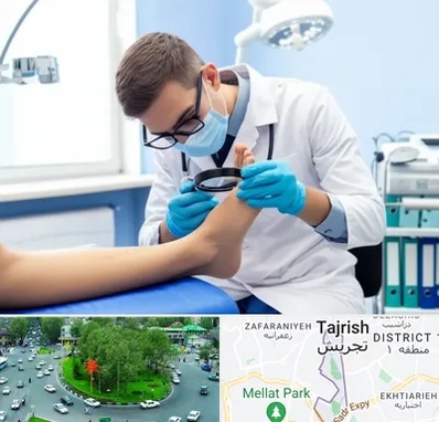 درمان زخم پای دیابتی در تجریش 