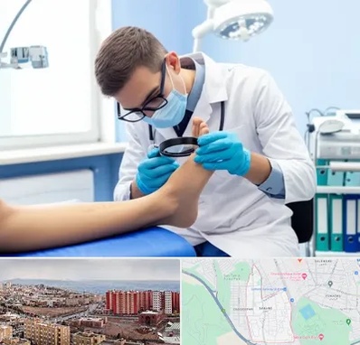 درمان زخم پای دیابتی در سهند تبریز 