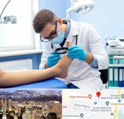 درمان زخم پای دیابتی در جردن 